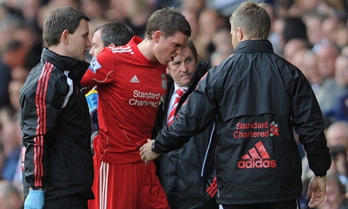 Liverpool Photo